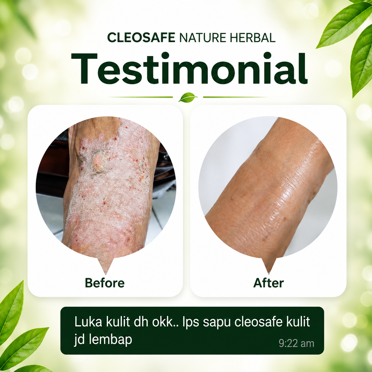 Testimoni CleoSafe