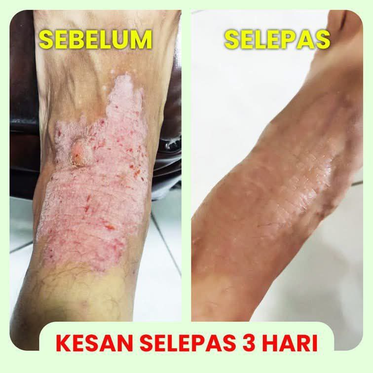 Testimoni Baru 2