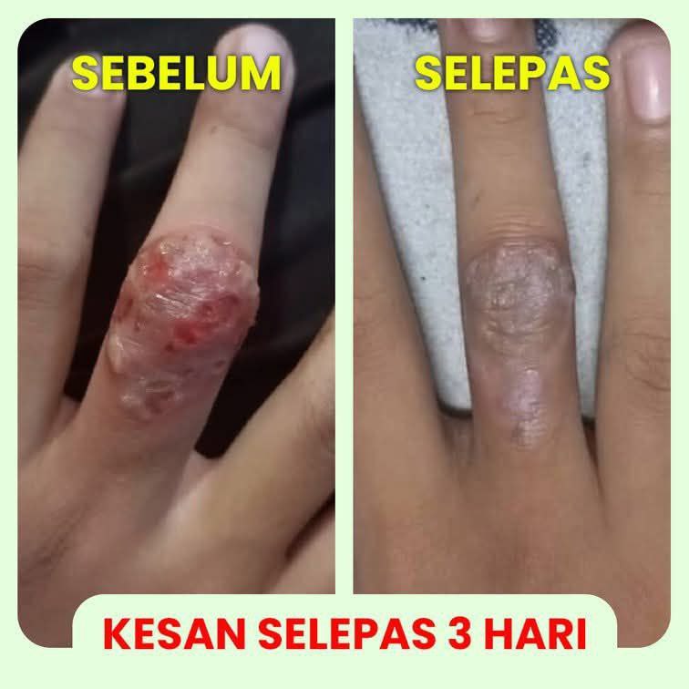 Testimoni Baru 4