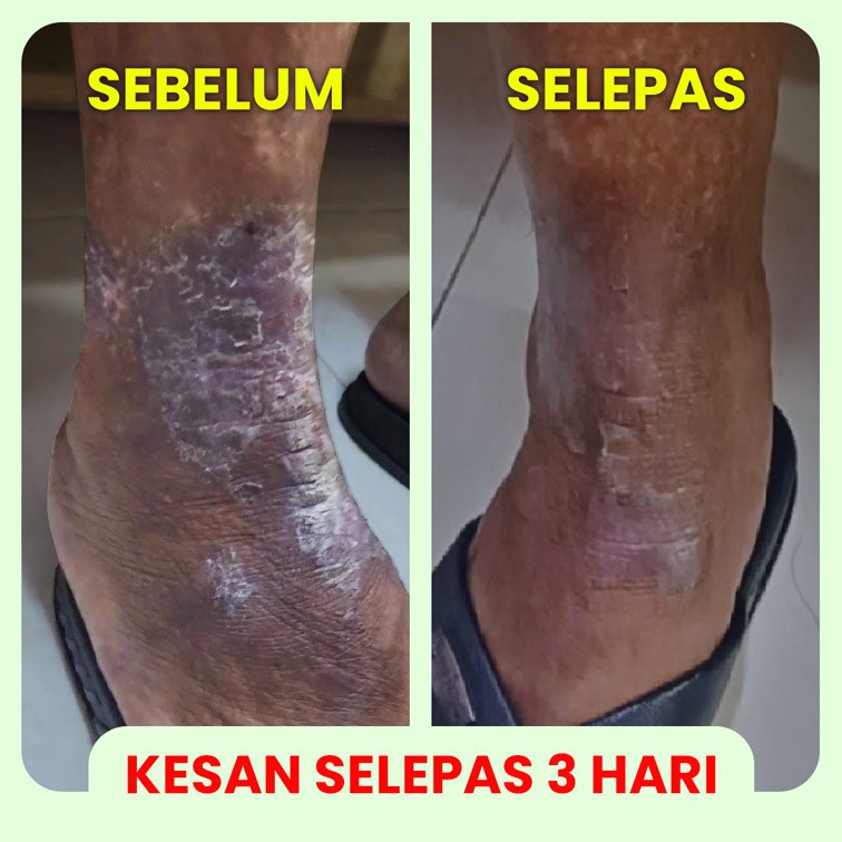 Testimoni Baru 1